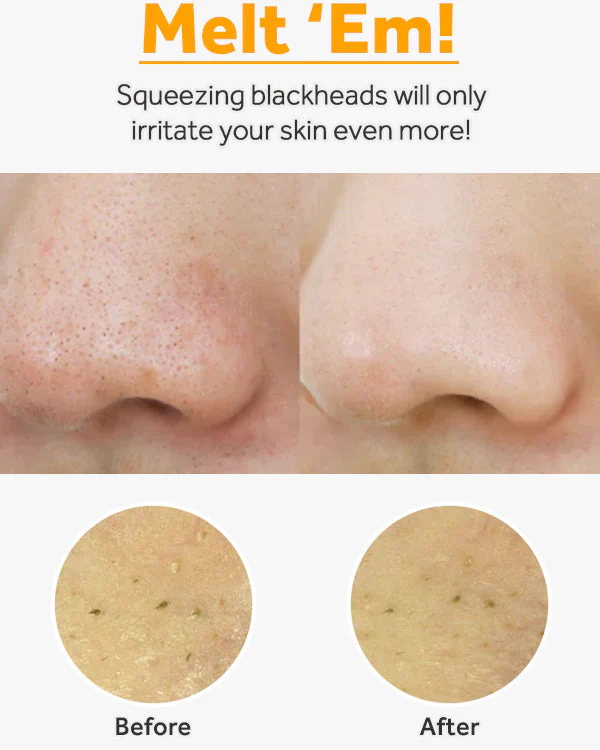 Pure Cleansing Oil - Image 8